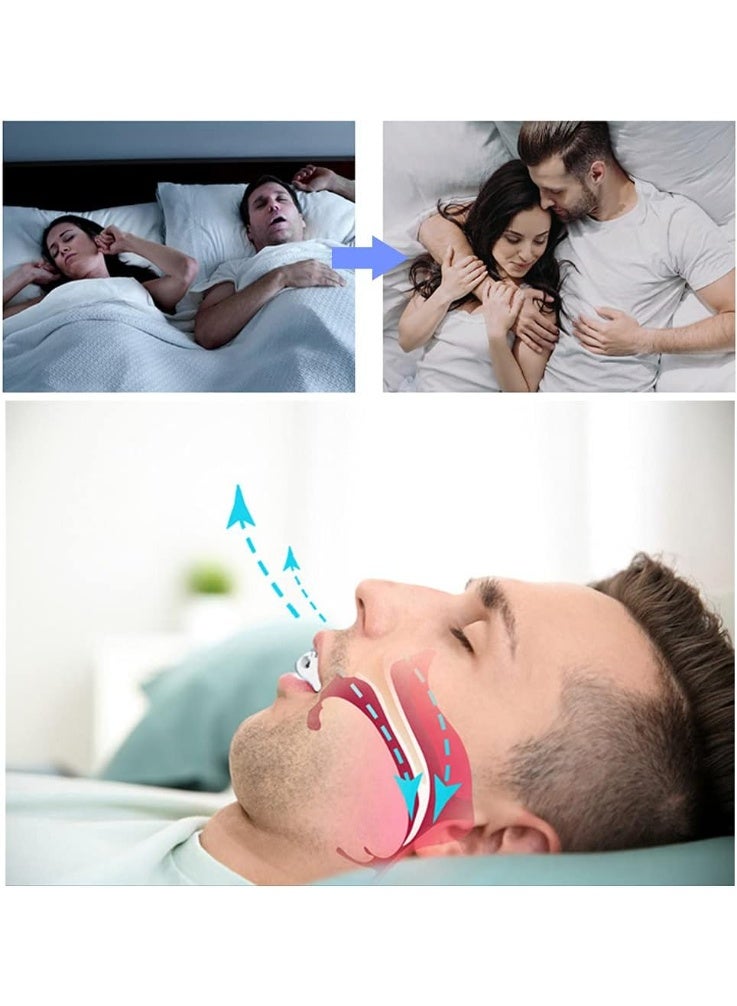 DUNISO Anti Snore Devices Snore Stopper Mouthpiece, Anti Snoring Night Mouth Guard, Sleep Aid for Grinding Teeth, Comfortable to Wear，Easy to Clean，for Prevent Teeth Grinding Disorder and Clenching at Night - Image 4