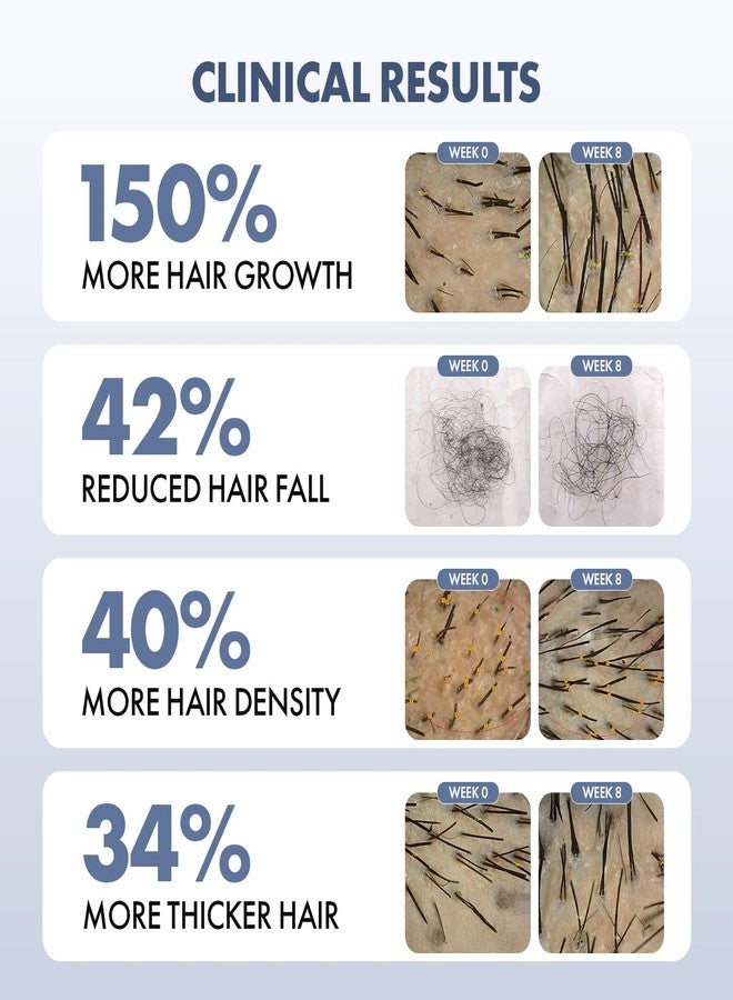 ثريفيكو سيروم نمو الشعر ThriveCo 2.0، عبوة من قطعتين (50 مل لكل قطعة) | علاج متطور لفروة الرأس مثبت سريريًا للتحكم في تساقط الشعر وإعادة نموه | ريدينسيل، أناجين، ريجينديل®، زيت إكليل الجبل | للرجال والنساء - Image 3