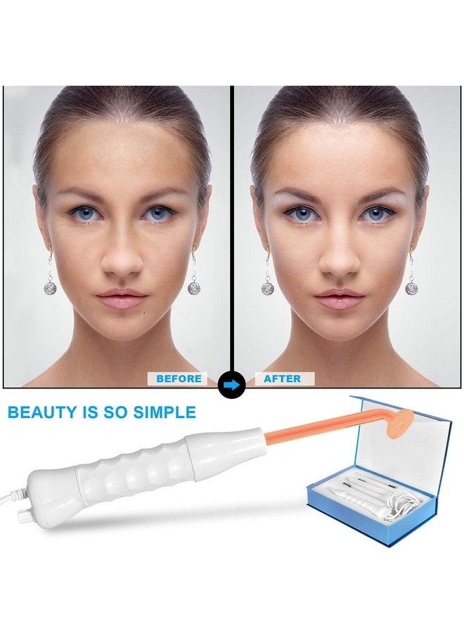 Concepta - Portable High Frequency Machine Facial Wand Acne For Skin Tightening Acne Spot Wrinkles Reducing Puffy Eyes Dark Circles Dispel Freckle 4 In 1 Handheld High Frequency Machine For Face & Hair - Image 1