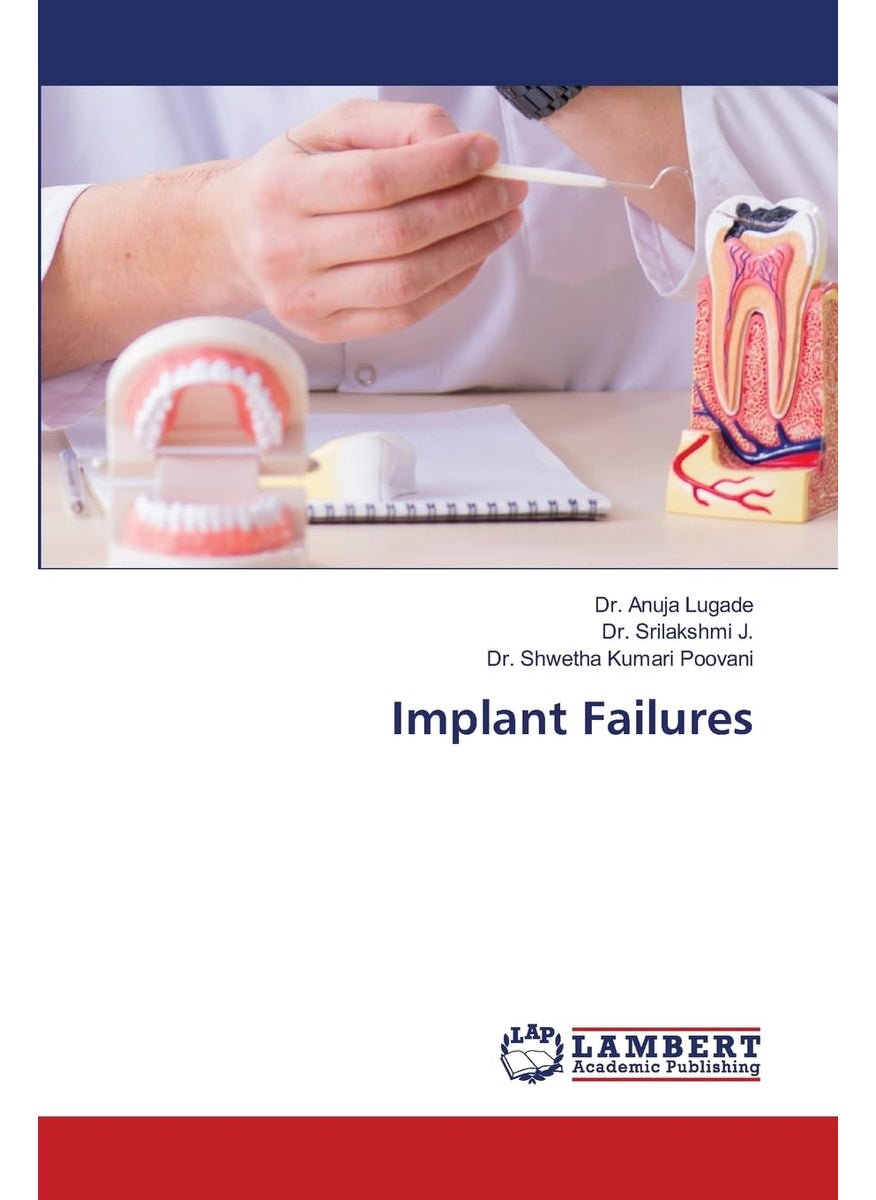 Implant Failures 