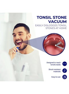ORAVIX Oravix Tonsil Stone Vacuum, Tonsil Stone Remover Vacuum Suction, Tonsil Stone Cupping Tool, Tonsil Stone Removal Tool with Suction, Tonsil Stones Removal Vacuum, Tonsil Stone Extractor - 3 in 1 Kit  - Image 2
