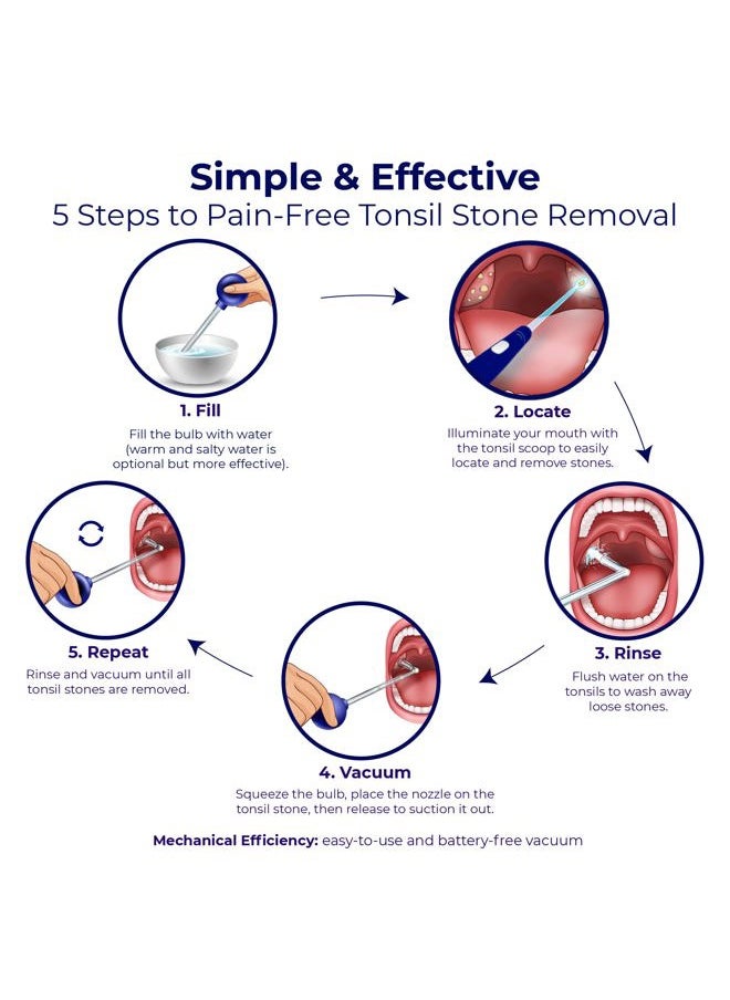 ORAVIX - Oravix Tonsil Stone Vacuum, Tonsil Stone Remover Vacuum Suction, Tonsil Stone Cupping Tool, Tonsil Stone Removal Tool with Suction, Tonsil Stones Removal Vacuum, Tonsil Stone Extractor - 3 in 1 Kit - Image 1