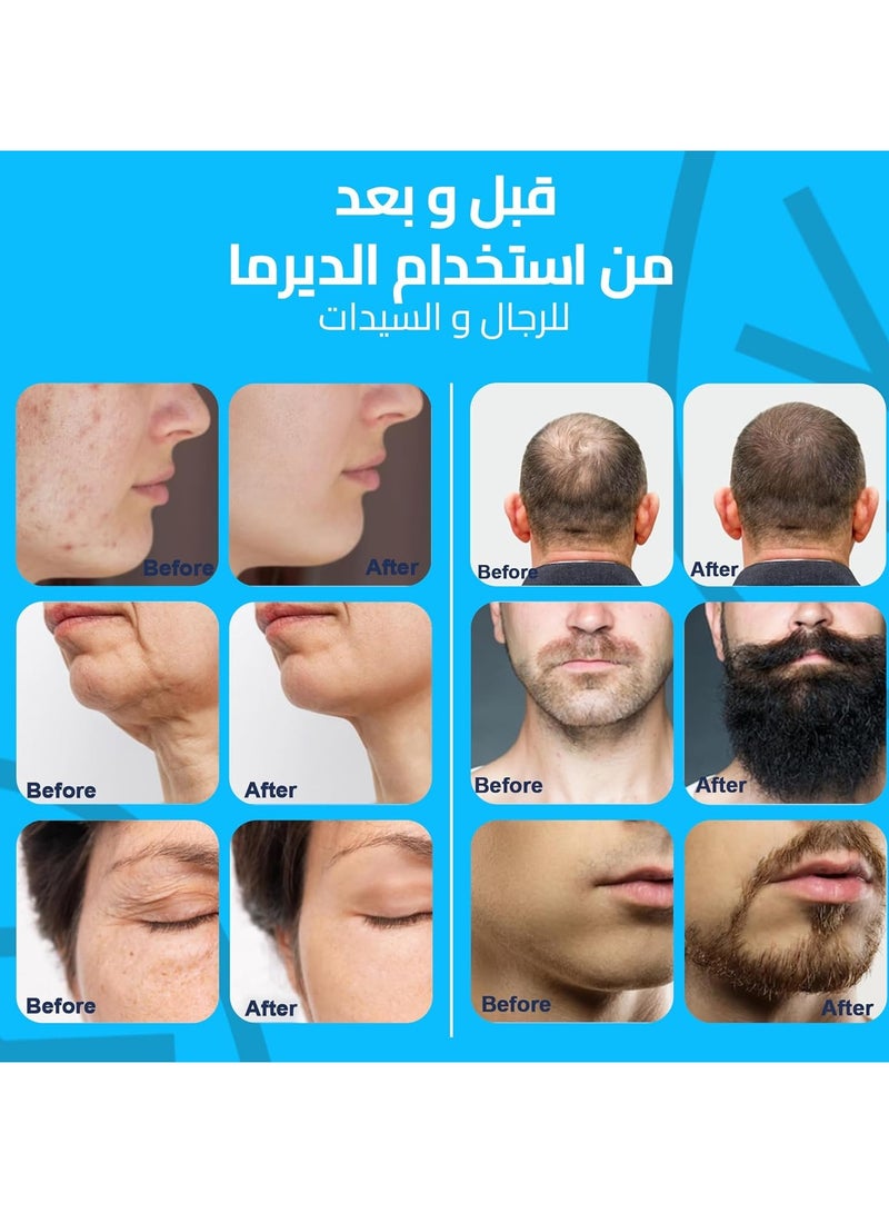 Derma Stamp adjustable Pen (0mm-3mm) with Titanium Needles - Image 5