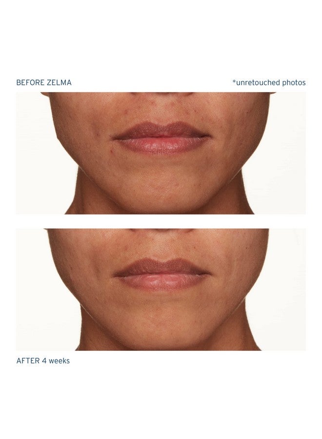 Santo Remedio, Piel Eterna, ZELMA Brightening Serum, Brightens and Improves Skin Tone, Contains Mineral Rescue Complex (Zinc, Selenium, Magnesium), For All Skin Types, 1 Fl. Oz. - Image 5