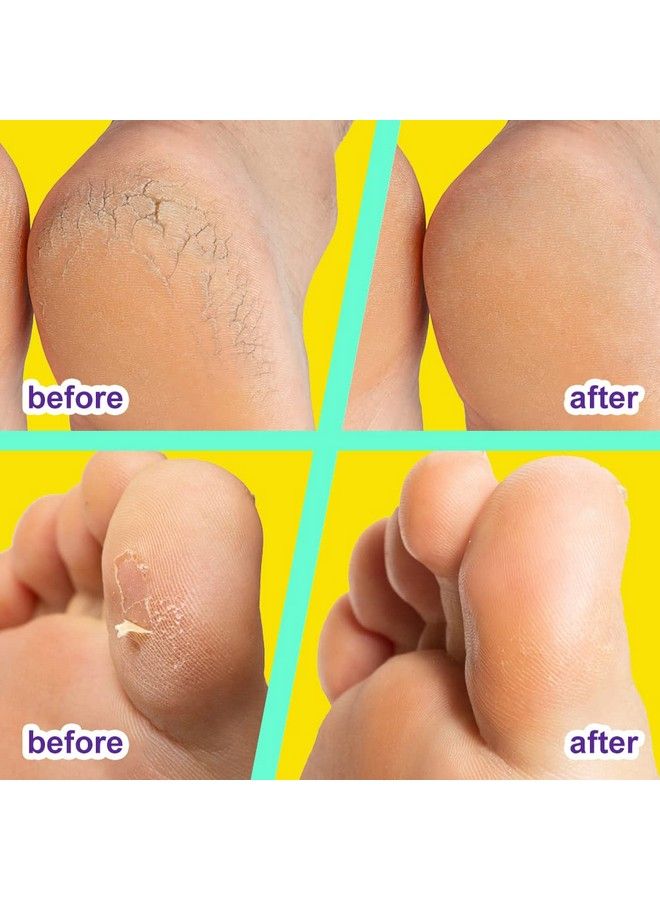 ENVISHA Urea Cream 42% For Feet 4 Oza Complete Calluscare Designed To A Complete Foot Cream & Specially Designed For Dry & Cracked Feet Hands Heels Elbows Nails Knees Strengthens And Softens Skin  - Image 5