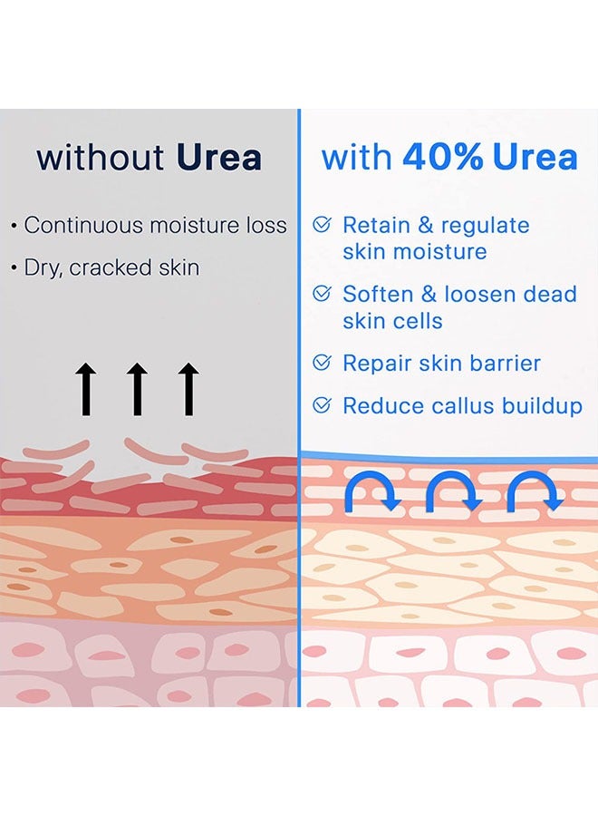 YURHERSU 40٪ كريم اليوريا + 2٪ حمض الساليسيليك ، علاج إصلاح القدمين المتشققين للقدمين والركبتين والمرفقين واليدين ، مرطب للبشرة لوشن اليوريا 50 جم - Image 4