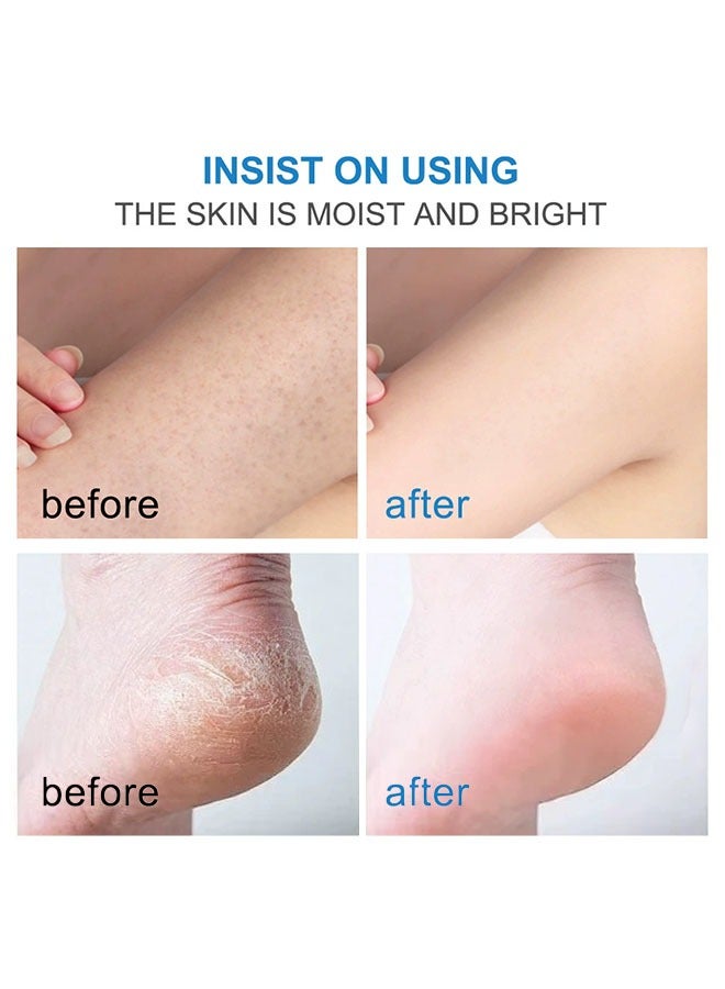 YURHERSU 40٪ كريم اليوريا + 2٪ حمض الساليسيليك ، علاج إصلاح القدمين المتشققين للقدمين والركبتين والمرفقين واليدين ، مرطب للبشرة لوشن اليوريا 50 جم - Image 5