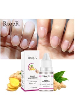 Ginger Anti-Bacterial Nail Repair Essential Oil Nail Treatment and Healthy Nails 10ml - pzsku/ZC26FDC4E950AF534C809Z/45/_/1651049010/6271671a-8528-45f9-b3c4-89e53eccdf7a