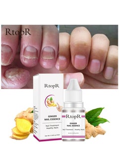 Ginger Anti-Bacterial Nail Repair Essential Oil Nail Treatment and Healthy Nails 10ml - pzsku/ZC26FDC4E950AF534C809Z/45/_/1651049010/ecb10518-5f12-4006-8cc3-00af1b3dc471