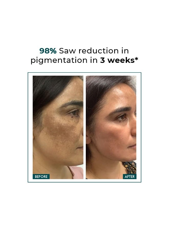Conscious Chemist Kojic Acid Face Cream | 20g | Azelaic Acid Cream for Men & Women with Niacinamide | Anti Pigmentation, Reduce Dark Spots, All Skin Type - Trubiom - Image 3