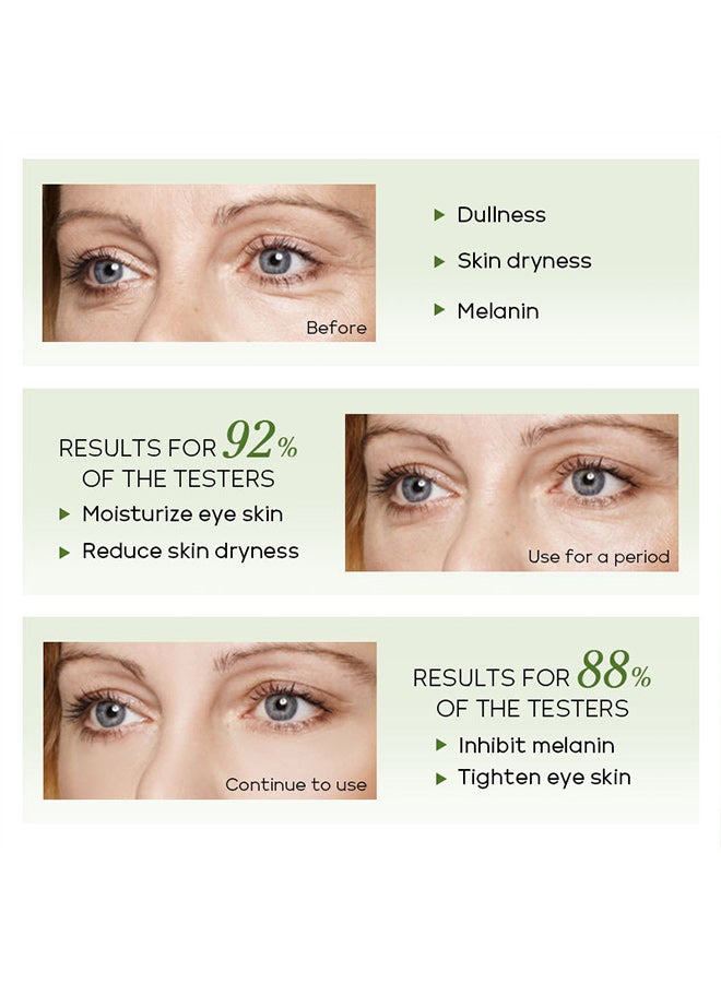 فيني مستحضر FENYI Green Tea Eye Essence لترطيب وتغذية البشرة حول العينين - Image 2