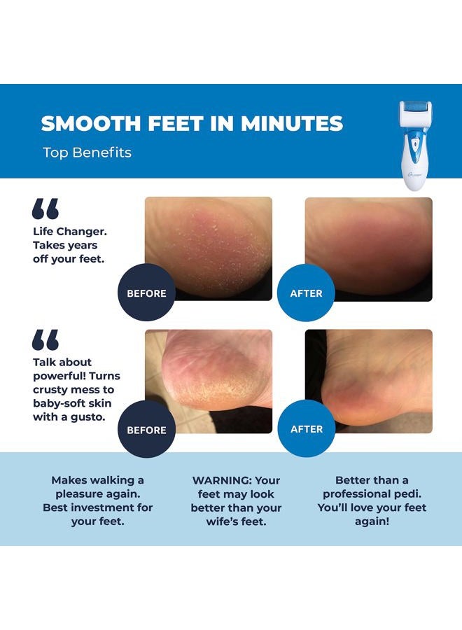 Own Harmony Electric Foot Callus Remover: Rechargeable Foot Scrubber File CR900 by Own Harmony - Best Pedicure Tools w 3 Rollers, Professional Pedi Feet Care Sander for Cracked Heels and Dead Skin (USB Cable) - Image 2