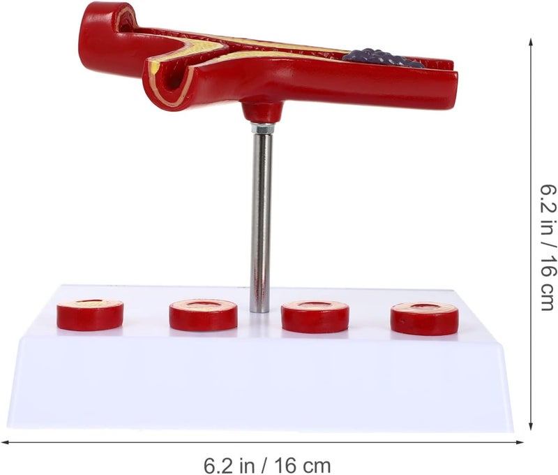 كلاراكو نموذج طبي لتصلب الشرايين البشري للقلب والأوعية الدموية: نموذج تشريحي للأوعية الدموية، لوازم تعليمية طبية لطلاب المدارس - Image 3
