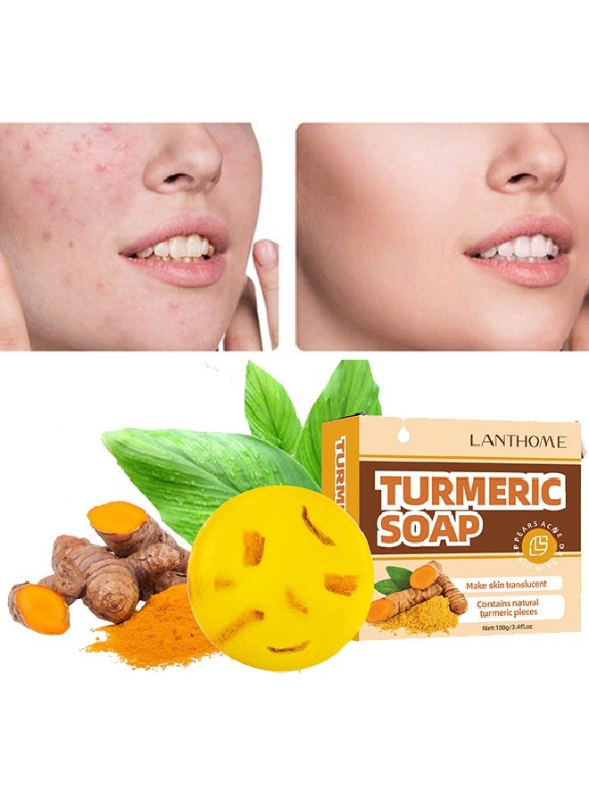Lanthome Turmeric Soap-Dark Spot Removing Soap, Face and Body Turmeric Soap, Whitening Turmeric Soap for Acne and Dark Spots,  Acne Facial Turmeric Acid Soap  - Image 1