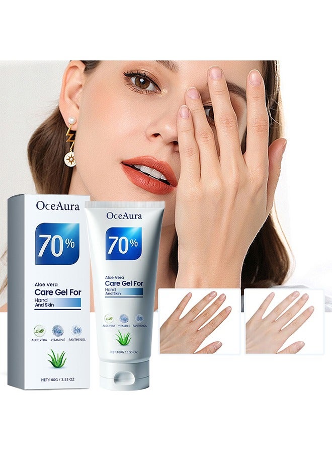 OceAura Aloe Vera Care Gel For Hand And Skin, Miracle Hand Cream, Aloe Vera Skin Care Gel, Repairing Aloe Vera Lotion, Moisturizing, Softening, Repairing, For Dry Hands, Hand Cream with Natural Aloe Vera and Vitamin E 100g - Image 1
