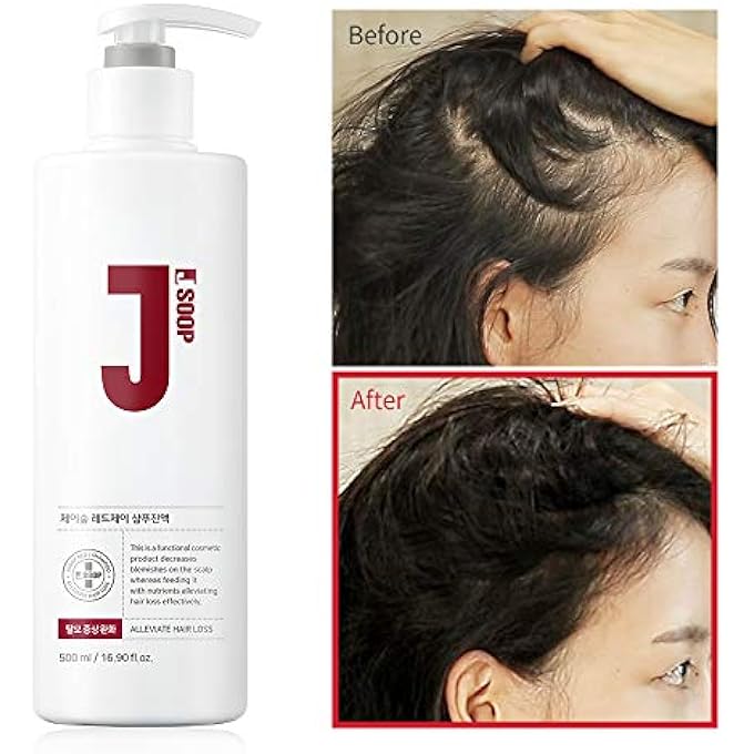 JSOOP RED J SHAMPOO 500ML / ANTI-HAIR LOSS, LOW SKIN IRRITATION, REDUCES REDNESS OF THE SCALP - Image 3