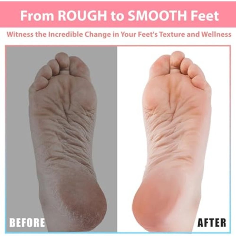 Shower Foot Scrubber Mat with Pumice Stone - Cleans, Smooths and Removes Dead Skin on Foot Without Bending, Foot Callus Remover with Non-Slip Suction Cups, Foot Scraper for Shower and Bathtub - Image 4