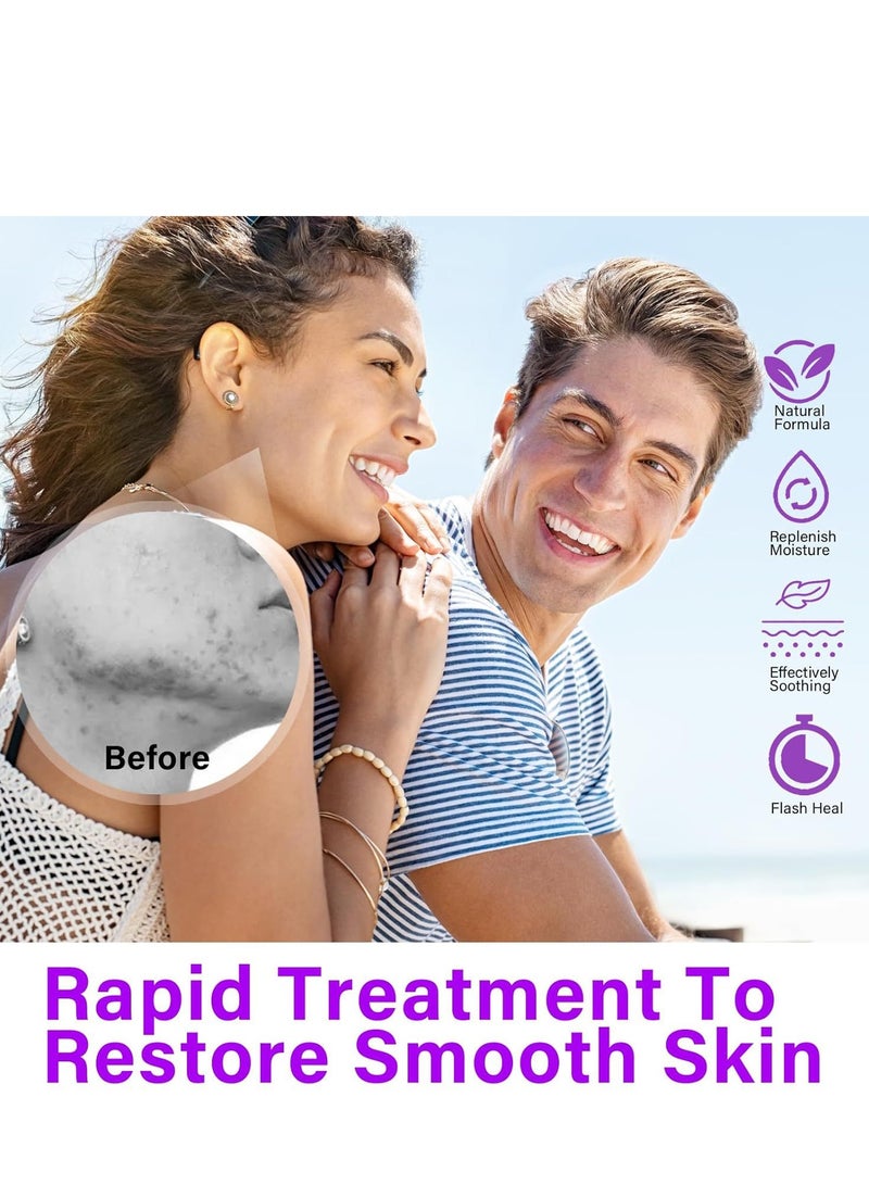 Azelaic Acid Serum, Booster 12% Azelaic Acid Cream, Hyaluronic Acid Serum & Niacinamide for Face, Facial Cream, Balance Excess Sebum,Smoothing Skin and Blemish,Pore Cleansing 1pcs - Image 4