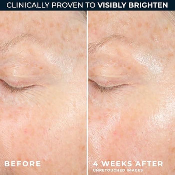 RoC Multi Correxion Revive + Glow 10% Vitamin C Moisturizer for Face, Anti-Aging Gel Cream, Instant Glow, Hypo-Allegenic, Oil-Free, 1.7 Ounces (Packaging May Vary - Image 5