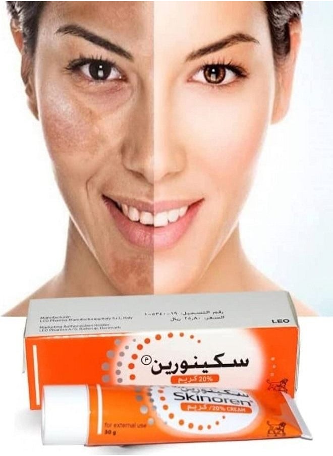 ليو كريم Skinoren لعلاج حب الشباب 30 جم  - Image 4