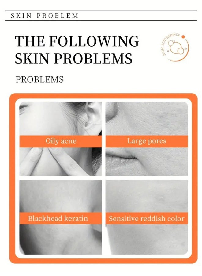 Kojic Acid Soap For Hyperpigmentation Gluta Thione .Collagen. Vtamin C Remover Soap Bars with Original Japanese Formula, Vitamin E, Retinol, Collagen, Hyaluronic Acid & Shea Butter for Even & Brighter Skin Tone, Face & Body - Image 4