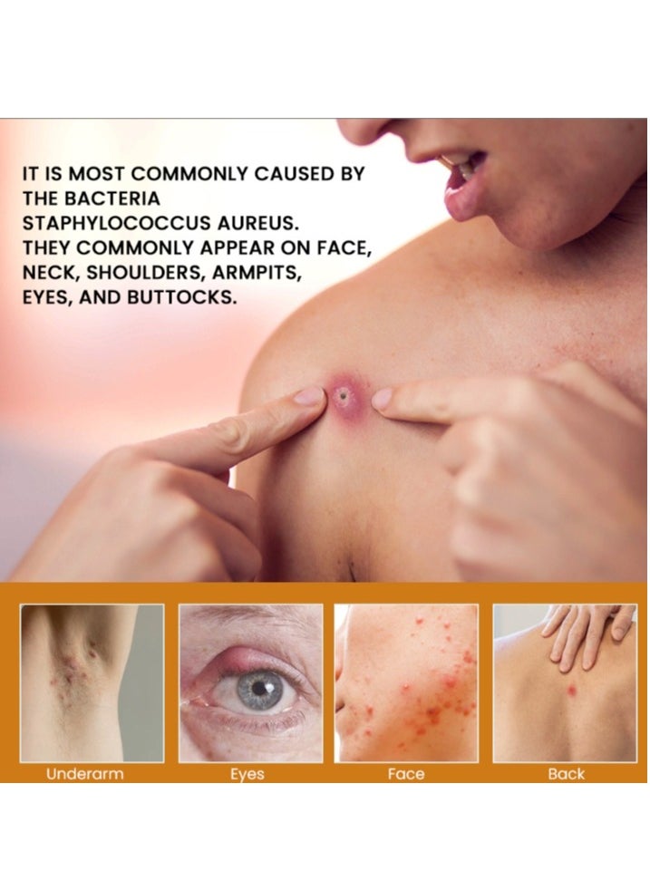 Sumifun Boil Relief Cream Reduces Heat and Swelling Alleviates Enlargement and Tenderness 20g  - Image 2