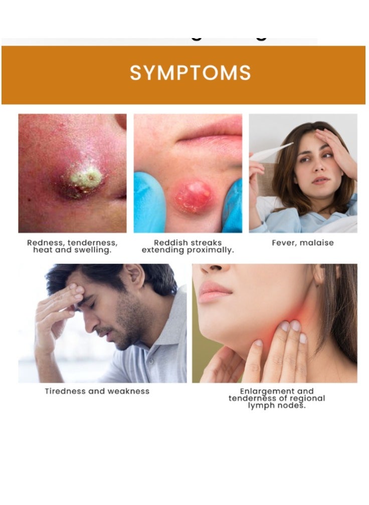 Sumifun Boil Relief Cream Reduces Heat and Swelling Alleviates Enlargement and Tenderness 20g  - Image 3
