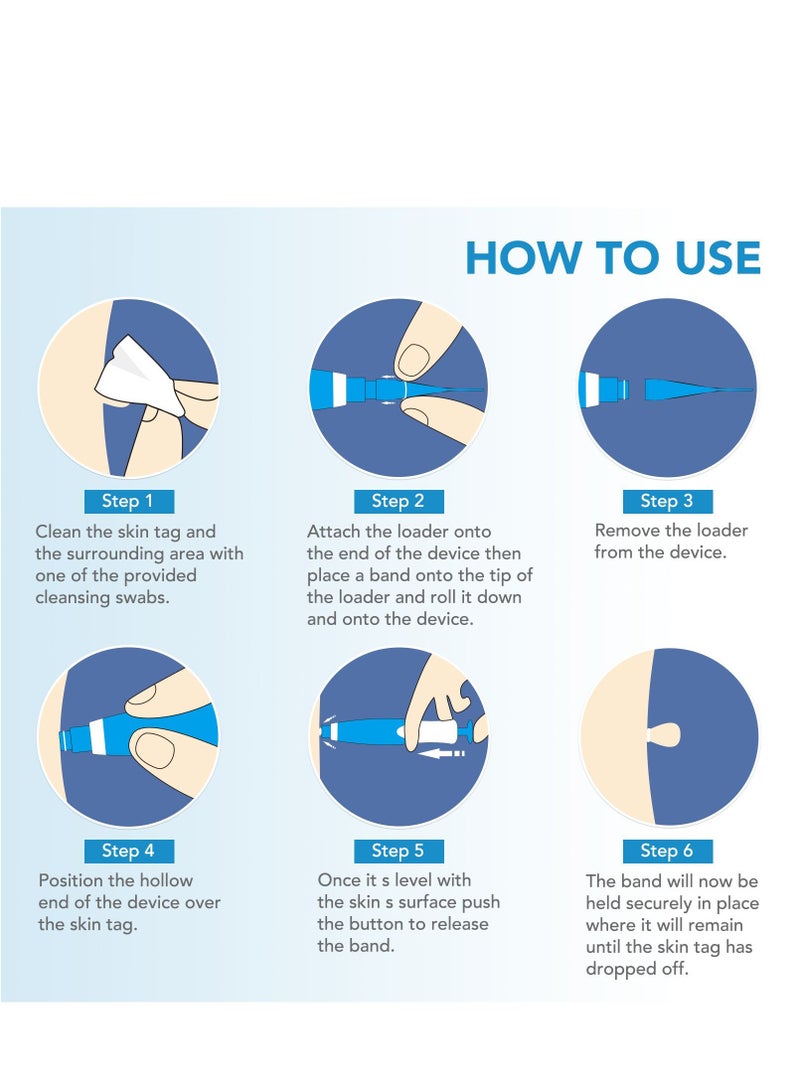 Sefudun Wart Removal Tool Skin Tag Removal Double Head Orange - Image 3