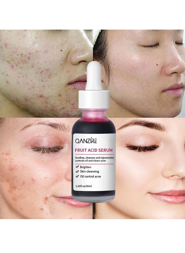 QANZIRE - Fruit acid serum to revitalize your skin facial serum for smooth and glowing skin premium facial serum for hydration and brightening anti-aging serum for all skin types - Image 1