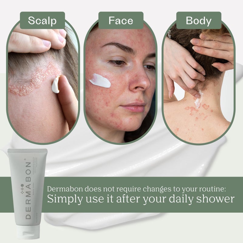 Dermabon Seborrheic Dermatitis Cream, Eczema & Psoriasis Treatment - Calendula Extract, Salicylic Acid, Bee Wax -Soothes, Hydrates & Balances Skin Tone - Moisturizing & Skin Relaxing Relief - Image 4