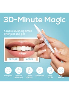 Teeth Whitening Pen (4 Pens), 40+ Uses - Teeth Whitening Gel With Professional Formulation And Ingredients - Best Teeth Whitener Overnight And No Tooth Sensitivity (Mint) - pzsku/ZC2CD4936D3D9F7EE79E0Z/45/_/1735214716/8ddd3acb-e154-4955-9645-0959bd0558c2