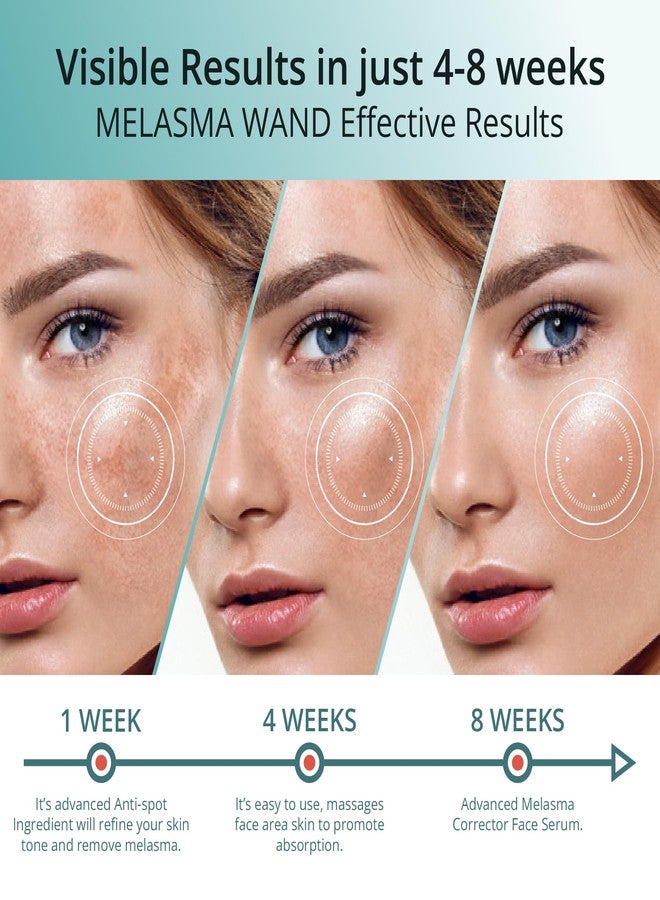 Abera Melasma Serum, Melanin Correcting Facial Serum, Dark Spot Corrector for Age Spot Sun Spot Freckles, Melasma Treatment for Face with HA & Niacinamide, All Skin Types, 0.68 Fl. Oz - Image 3