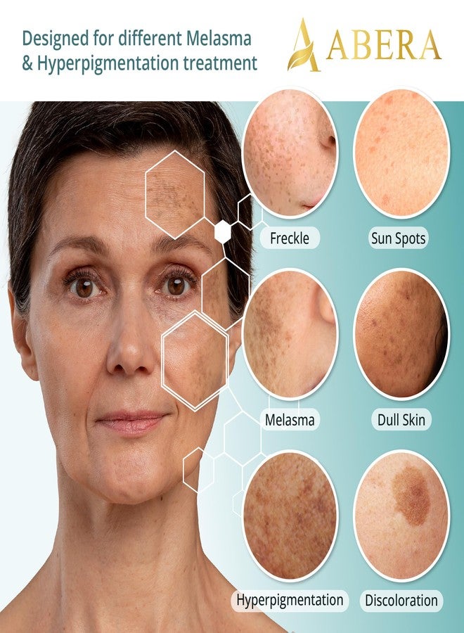 Abera Melasma Serum, Melanin Correcting Facial Serum, Dark Spot Corrector for Age Spot Sun Spot Freckles, Melasma Treatment for Face with HA & Niacinamide, All Skin Types, 0.68 Fl. Oz - Image 4
