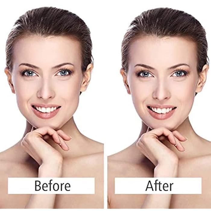 Face-Lift Mask Facial Lifting Slimming Belt V Line Mask Neck Compression Double Chin Cheek Slim Lift Up Anti Wrinkle Mask - Image 2