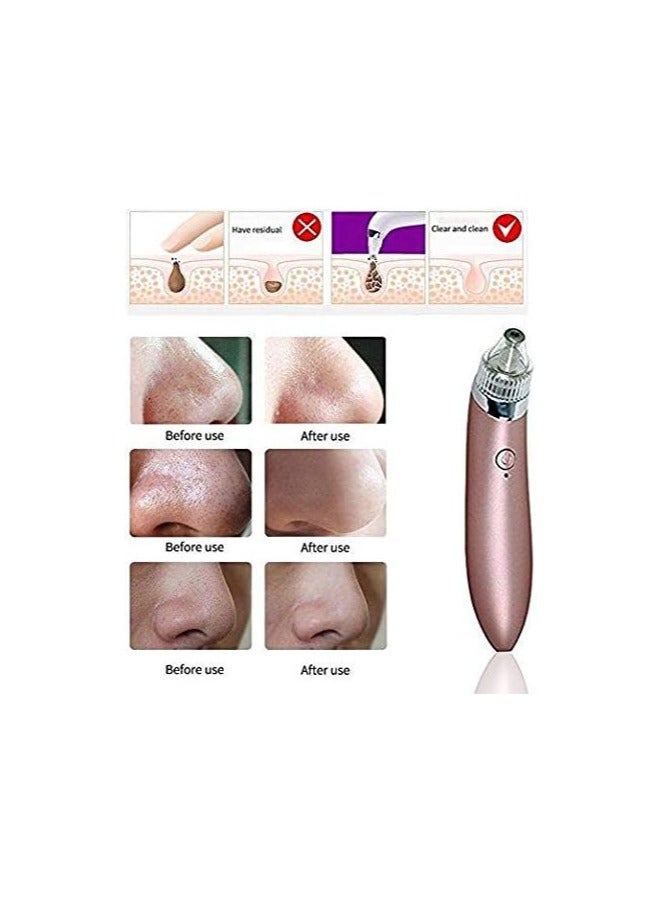 Generic Electric Vacuum Pore Cleanser And Blackhead Remover Multicolour  - Image 2