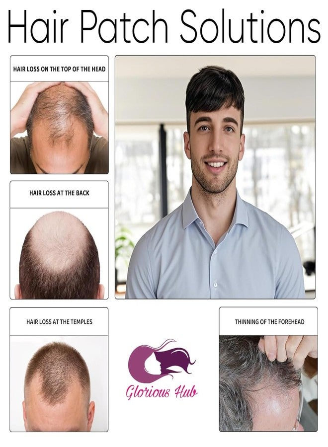 رقعة شعر رجالي Glorious Hub® 9x7 Fine R Mono، قاعدة أحادية الخيوط متينة، شعر مستعار من شعر بشري 100%، نظام شعر/شعر مستعار مريح - يتم تثبيته بمشابك أو شريط لاصق أو غراء (بني) - Image 4