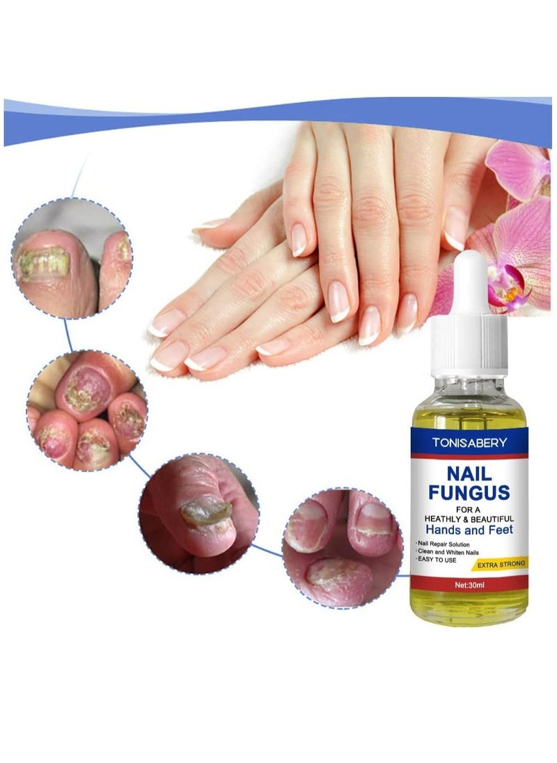 TONISABERY - Nail Fungus Solution For Cracked & Discolored Nails Natural Safe Effective Repairs & Protects Removes Nail Infections Nourishing Fluid for Hand & Feet No Side Effects Irritation Unisex 30ml - Image 1