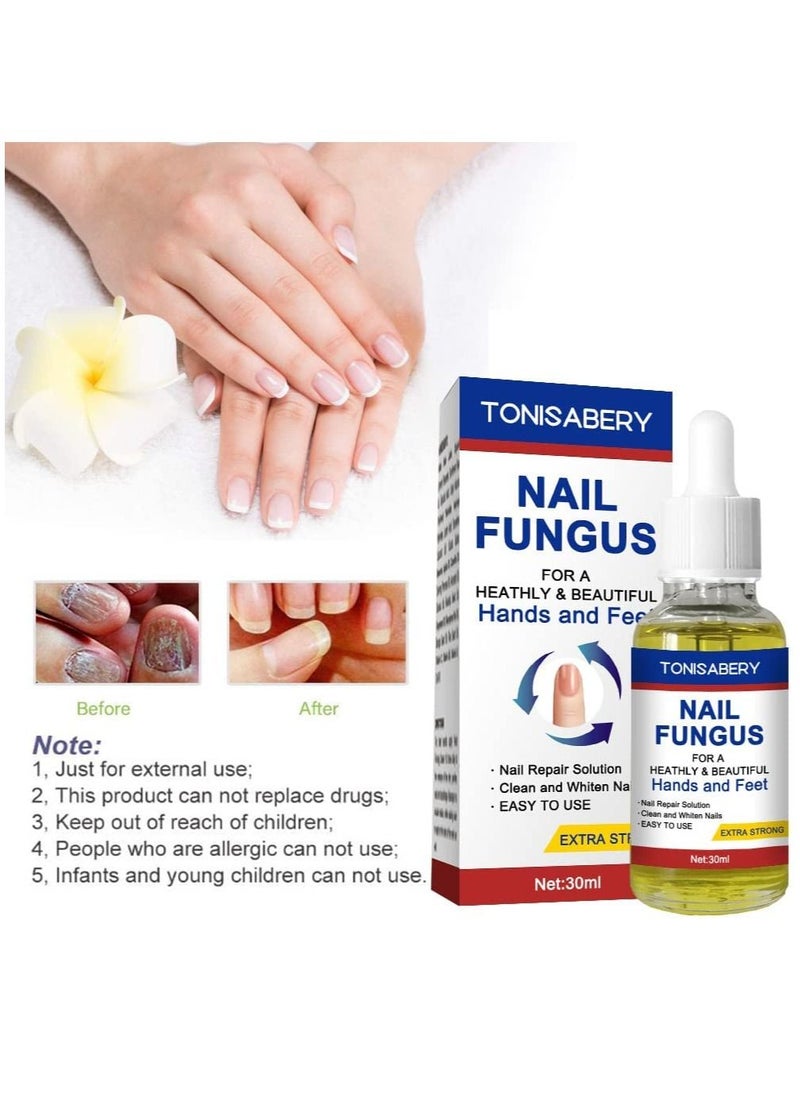 TONISABERY - Nail Fungus Solution For Cracked & Discolored Nails Natural Safe Effective Repairs & Protects Removes Nail Infections Nourishing Fluid for Hand & Feet No Side Effects Irritation Unisex 30ml - Image 1