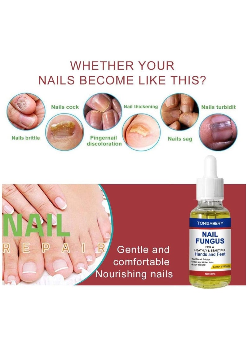 TONISABERY - Nail Fungus Solution For Cracked & Discolored Nails Natural Safe Effective Repairs & Protects Removes Nail Infections Nourishing Fluid for Hand & Feet No Side Effects Irritation Unisex 30ml - Image 1