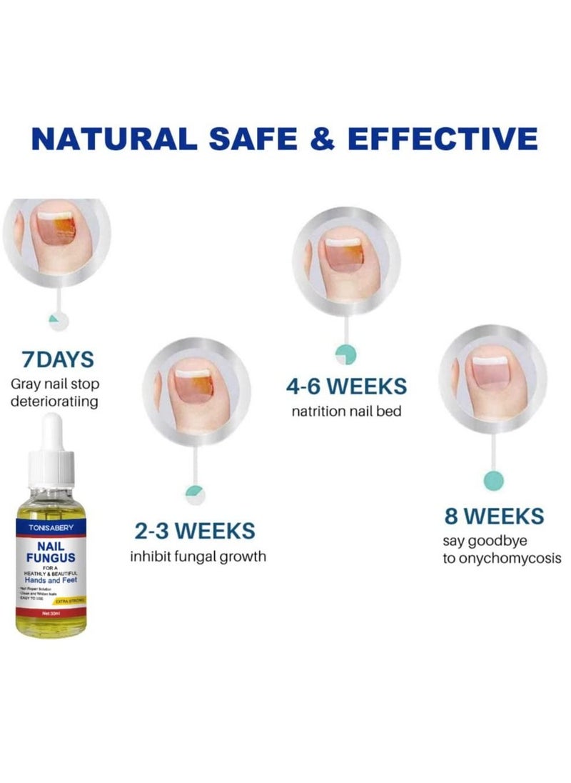 TONISABERY - Nail Fungus Solution For Cracked & Discolored Nails Natural Safe Effective Repairs & Protects Removes Nail Infections Nourishing Fluid for Hand & Feet No Side Effects Irritation Unisex 30ml - Image 1