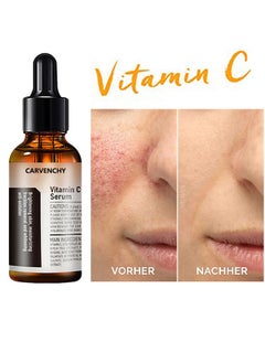 CARVENCHY Vitamin C Facial Serum, Anti-Aging Serum with Hyaluronic Acid and Vitamin E, Moisturizing and Brightening Serum for Dark Spots, Fine Lines and Wrinkles, 30ml  - Image 1