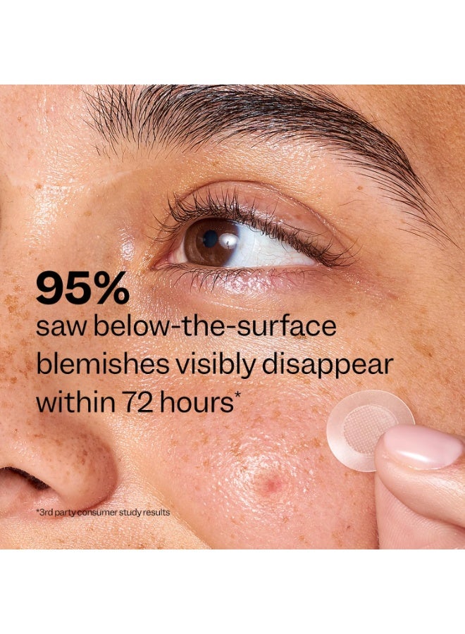 Peach Slices - Deep Blemish Microdarts (9 ct) - Early Stage Pimple Patches for Face - Salicylic Acid, Niacinamide, Hyaluronic Acid, Tea Tree Oil & Cica - Vegan, Cruelty Free, Korean Skin Care & Beauty - Image 4