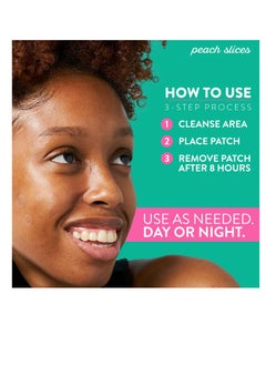 Peach Slices Peach Slices | Deep Blemish Microdarts | Acne Patch | Early Stage & Deep Pimples | Fast-Acting | Salicylic Acid | Tea Tree Oil | Niacinamide | Cica | Hyaluronic Acid | Spot Treatment | 9 Patches  - Image 5