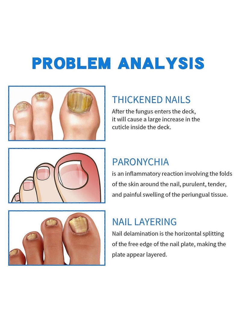 Sumifun Nail Repair Cream - Nail Toe Cream, Nail Cream Anti Harmful Substances Repair Finger Toe Nail Care Perfect for Men and Women Home Use 15g - Image 4