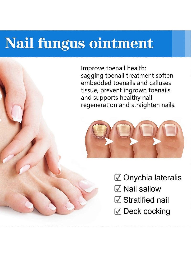 Sumifun Nail Repair Cream - Nail Toe Cream, Nail Cream Anti Harmful Substances Repair Finger Toe Nail Care Perfect for Men and Women Home Use 15g - Image 5