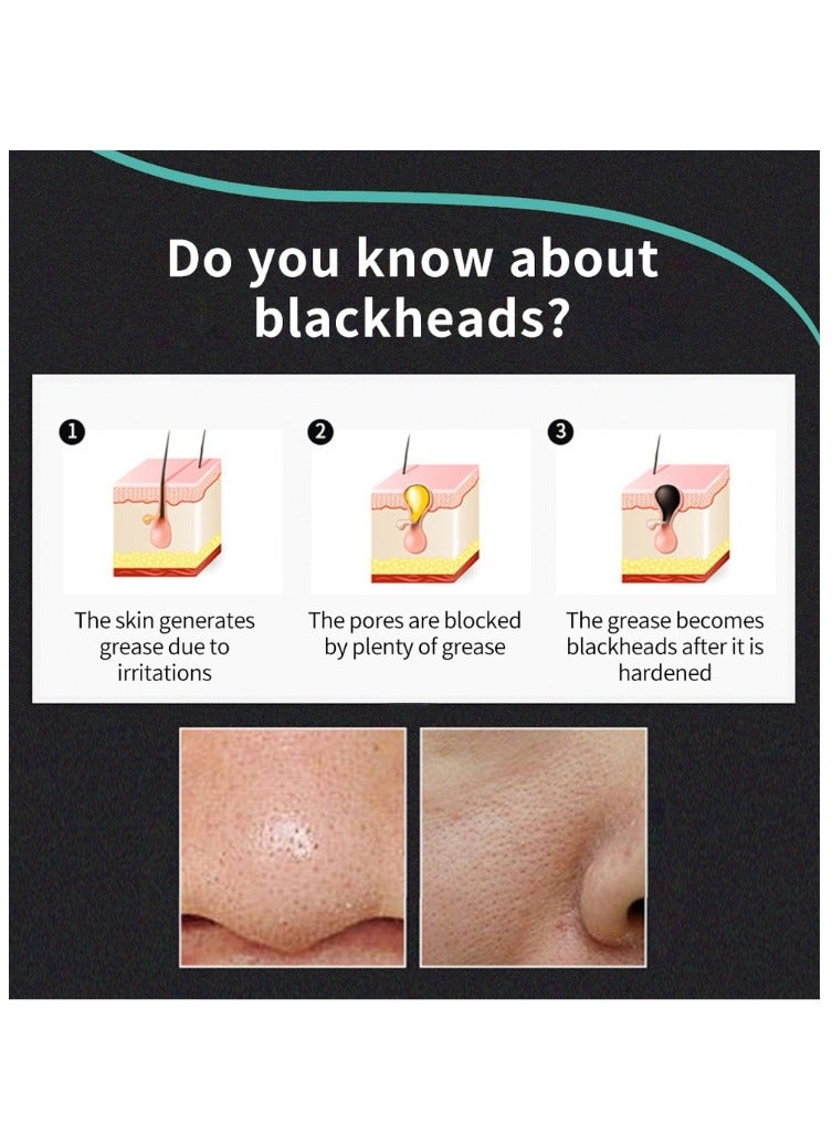 LANBENA Nose Pore Strips Gentle In Blackhead Remover Blackhead Nose Charcoal Blackhead Remover Pore Strips for Face Nose Pores - Image 5