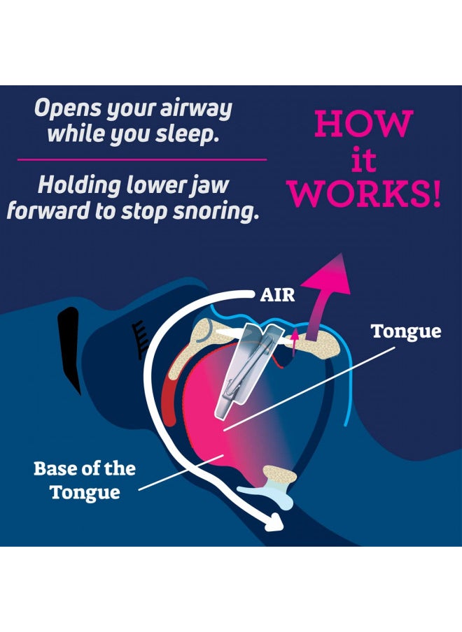 SmartGuard - Anti-Snore Device by SmartGuard. New Customizable Snore Reducing Mouthpiece Reduce Snoring Aid for Men and Women Most Comfortable and Adjustable Oral Appliance - Holds Jaw Forward to Open Airway - Image 1