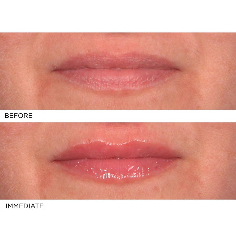 NassifMD Hydro-Screen with Hyaluronic Acid Lip Pluming Oil Formula for Dry Lips, Hydrating Softening Lip Maximizing Serum, Ceramide Jojoba Glaze Gloss - Image 3