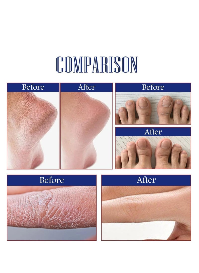 SOUTH MOON - Hand Cream for Women, Hand and Foot Peeling Cream, Foot Care for Cracked Heels, Heals and Moisturizes, Moisturizing Foot Peeling Cream and Lotion for Dry Feet 50g - Image 1