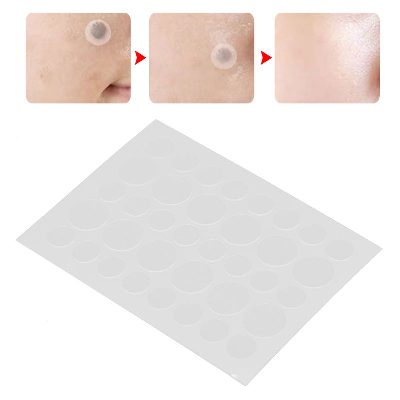 36 Patches Skin Tag Cover Patches Mole Acne Pimple Covers Concealing Patch Sticker - Image 1